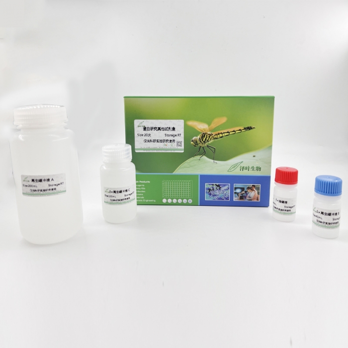 微量蛋白沉淀试剂盒ZY61217 - 泽叶生物-ELISA试剂盒,试剂盒,检测试剂盒 