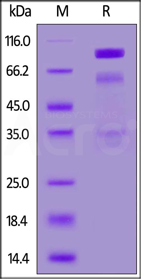 Human HGF, His Tag (Cat. No. HGF-H52H3) SDS-PAGE gel