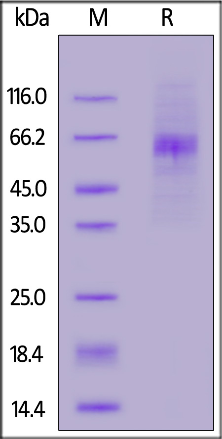 Mouse IFN-alpha / beta R1, His Tag (Cat. No. IF1-M5225) SDS-PAGE gel