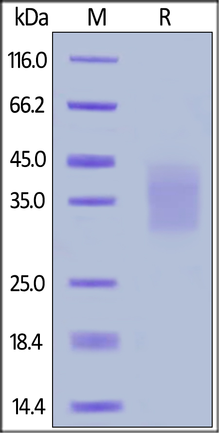 Human SCF, His Tag (Cat. No. SCF-H4219) SDS-PAGE gel