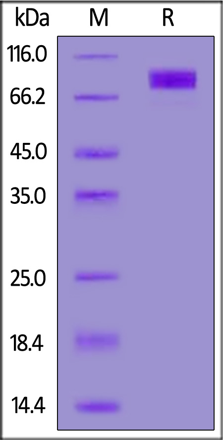 Biotinylated Human CD117, His,Avitag (Cat. No. CD7-H82E6) SDS-PAGE gel